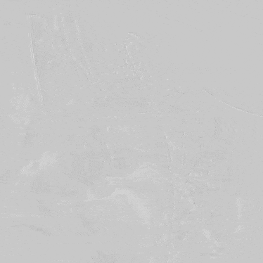 医疗胸带怎么穿周斌教授团队：仅使用0.014＂导丝软头穿膜原位开窗精准重建LSA治疗复杂胸主动脉病例分享_https://www.jmylbn.com_新闻资讯_第23张