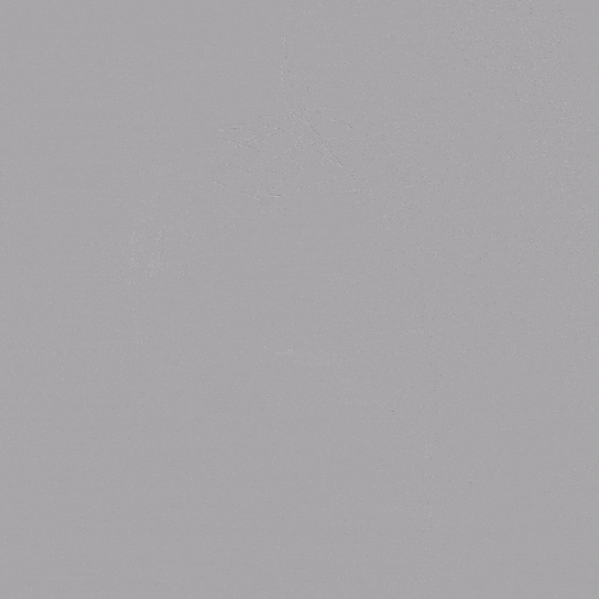 泥鳅导丝怎么用郎德海、胡松杰教授团队：浙江省首例使用0.035″泥鳅导丝软头柔性破壁原位重建LSA_https://www.jmylbn.com_新闻资讯_第23张