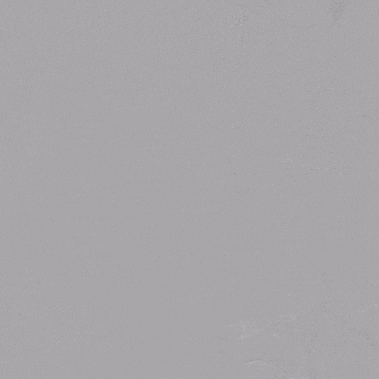 泥鳅导丝怎么用郎德海、胡松杰教授团队：浙江省首例使用0.035″泥鳅导丝软头柔性破壁原位重建LSA_https://www.jmylbn.com_新闻资讯_第9张