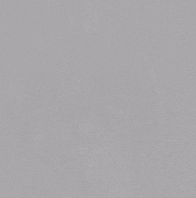 泥鳅导丝怎么用郎德海、胡松杰教授团队：浙江省首例使用0.035″泥鳅导丝软头柔性破壁原位重建LSA_https://www.jmylbn.com_新闻资讯_第11张