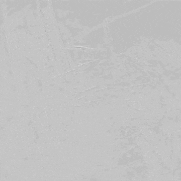 医疗胸带怎么穿周斌教授团队：仅使用0.014＂导丝软头穿膜原位开窗精准重建LSA治疗复杂胸主动脉病例分享_https://www.jmylbn.com_新闻资讯_第21张