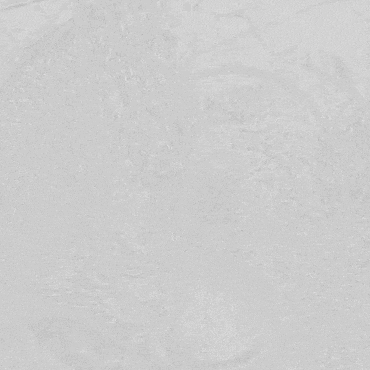 医疗胸带怎么穿周斌教授团队：仅使用0.014＂导丝软头穿膜原位开窗精准重建LSA治疗复杂胸主动脉病例分享_https://www.jmylbn.com_新闻资讯_第10张
