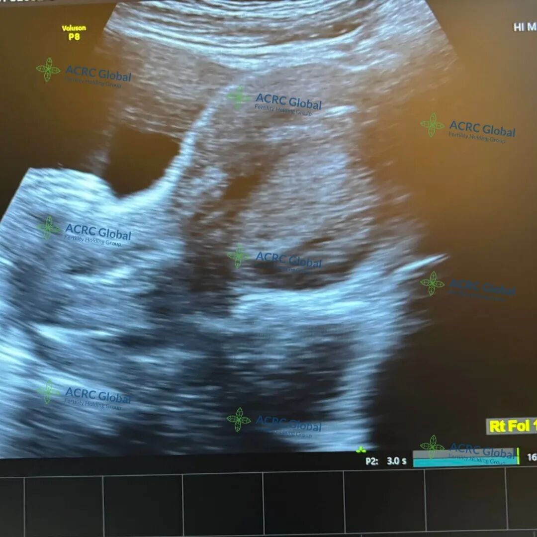 代母日常 (7).jpg