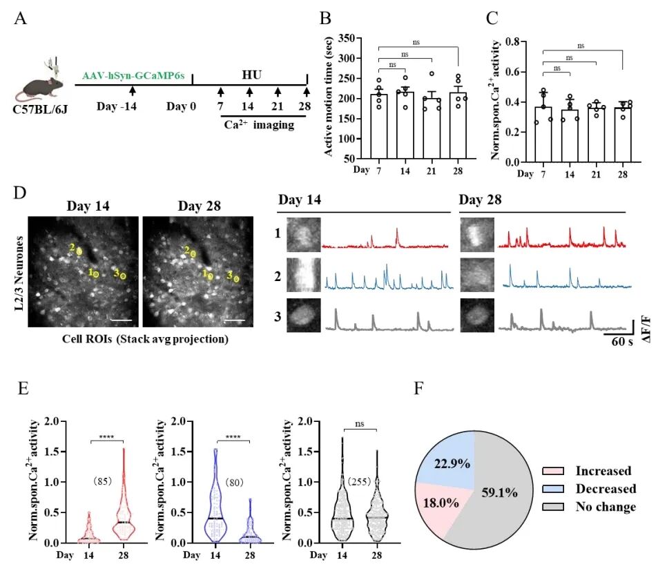 揭示模擬失重致后肢運動皮層神經元活動時序性變化的特征及機制