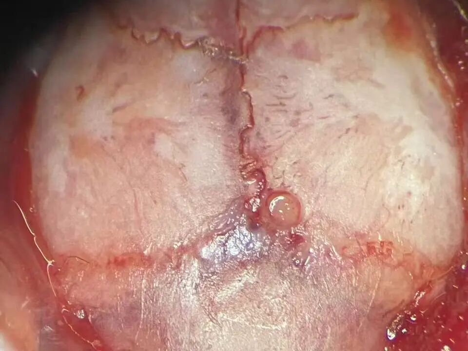 技術實操丨從“開窗