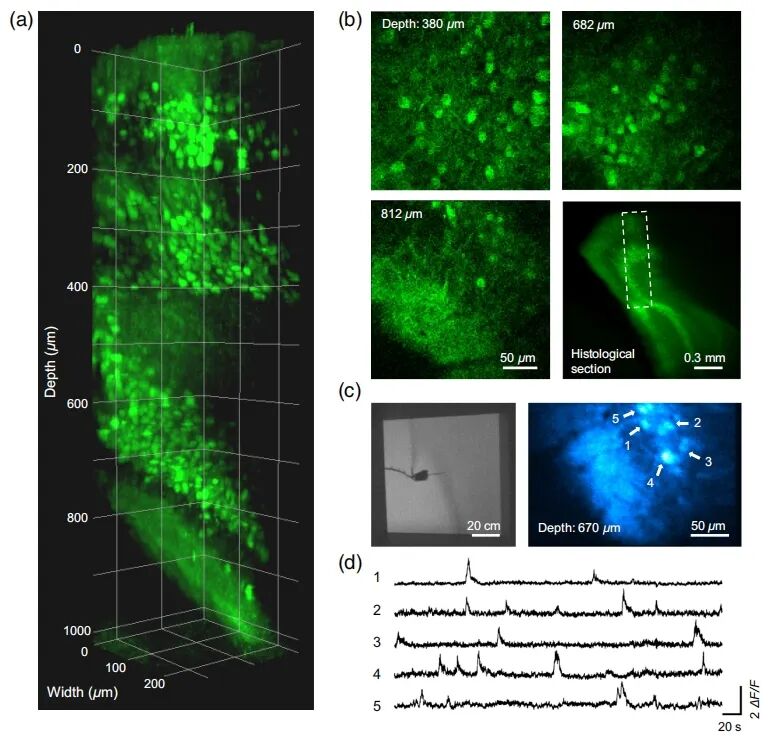 吳潤(rùn)龍課題組開發(fā)寬視場(chǎng)熒光導(dǎo)航系統(tǒng)，賦能自由行為動(dòng)物高效多光子成像