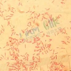 革兰氏阴性短杆菌