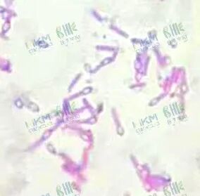 革兰阳性梭菌，有或无卵圆形或球形的芽孢