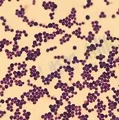 革兰氏阳性球菌