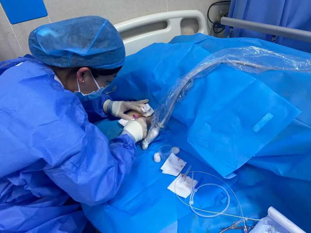 为什么输液要盖块纱布健康科普 ｜ 给血管装个“保护盾”：聊聊长期输液患者的“救命线”PICC_https://www.jmylbn.com_新闻资讯_第7张