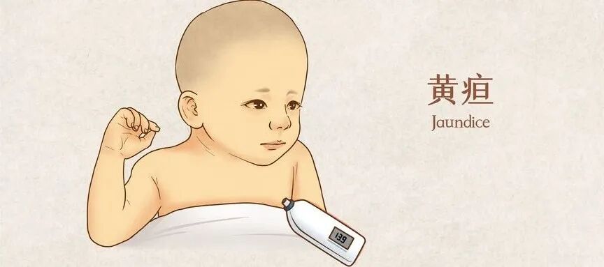 为什么要用光疗纸尿裤健康惠民 ｜ 不用住院 ，随治随走！新生儿日间光疗新模式了解一下_https://www.jmylbn.com_新闻资讯_第6张