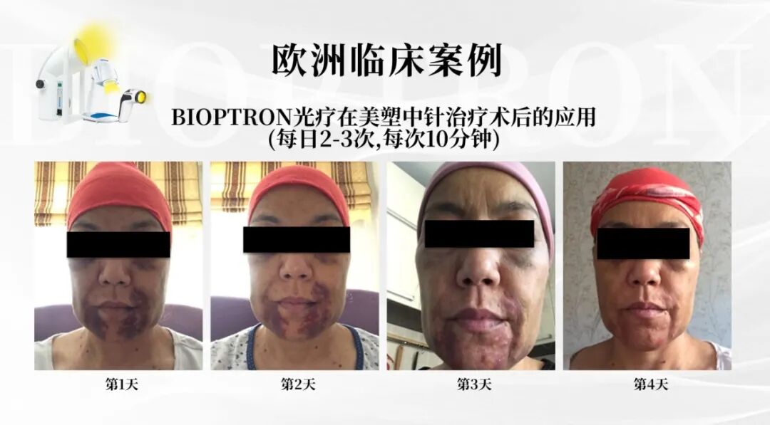 案例3.jpg