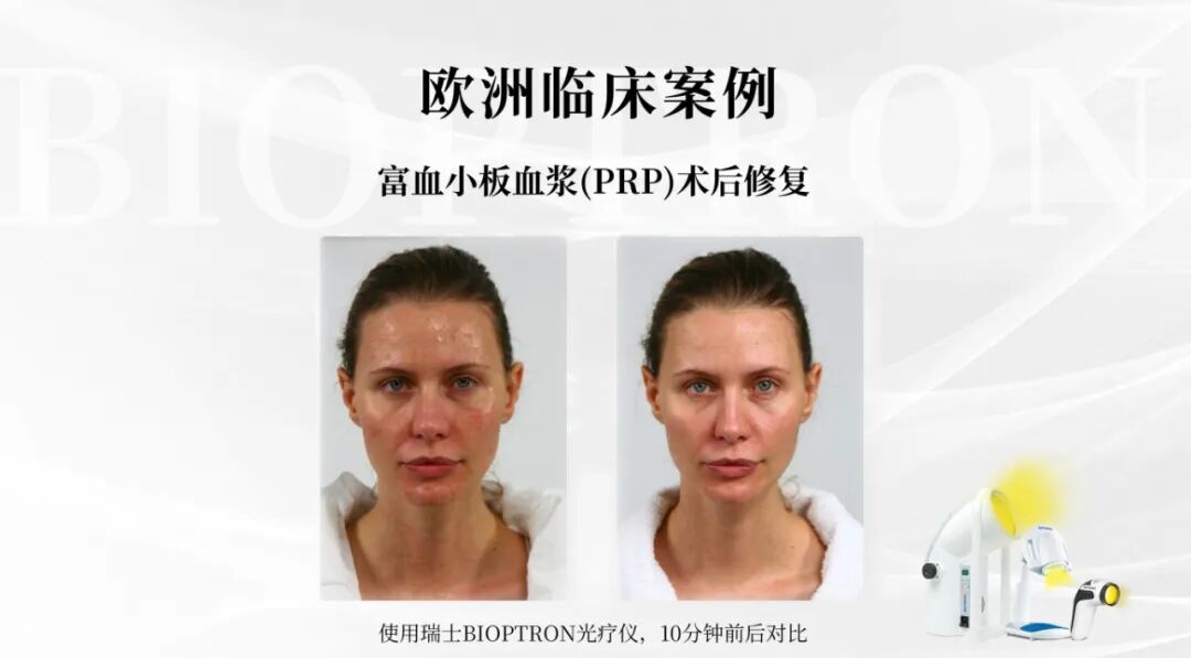 案例1.jpg
