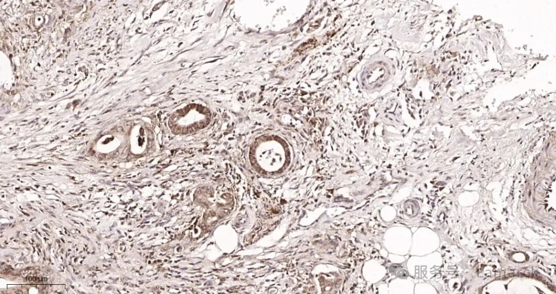 AR0003_2  Human colon tissue.jpg