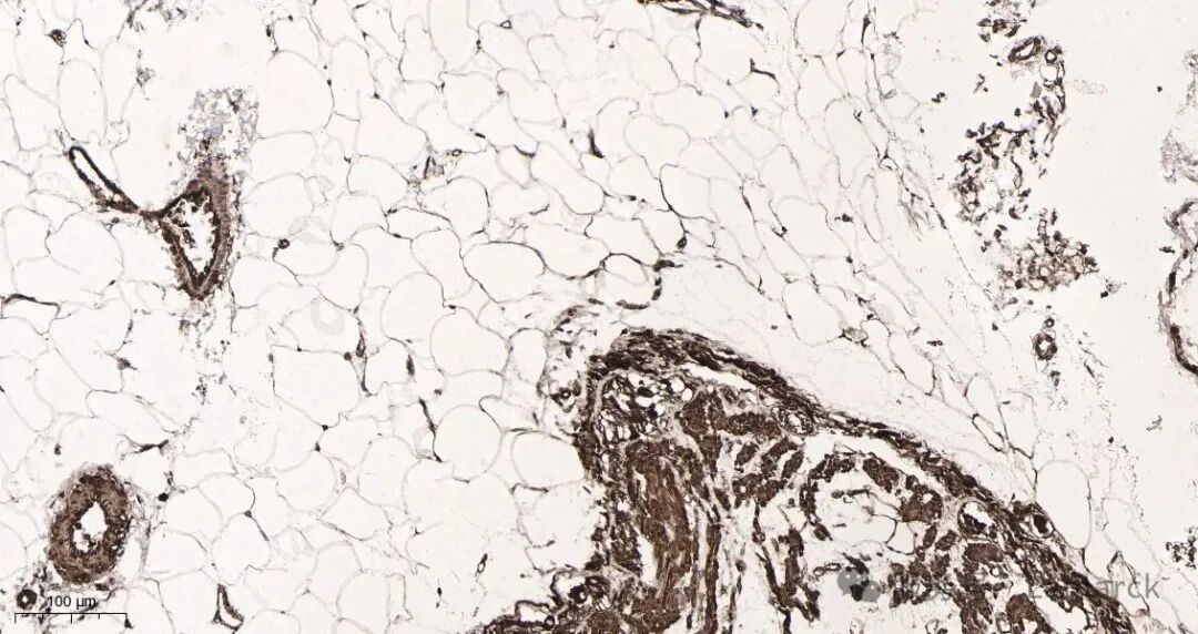 AR0025_3  Rat colon tissue.jpg