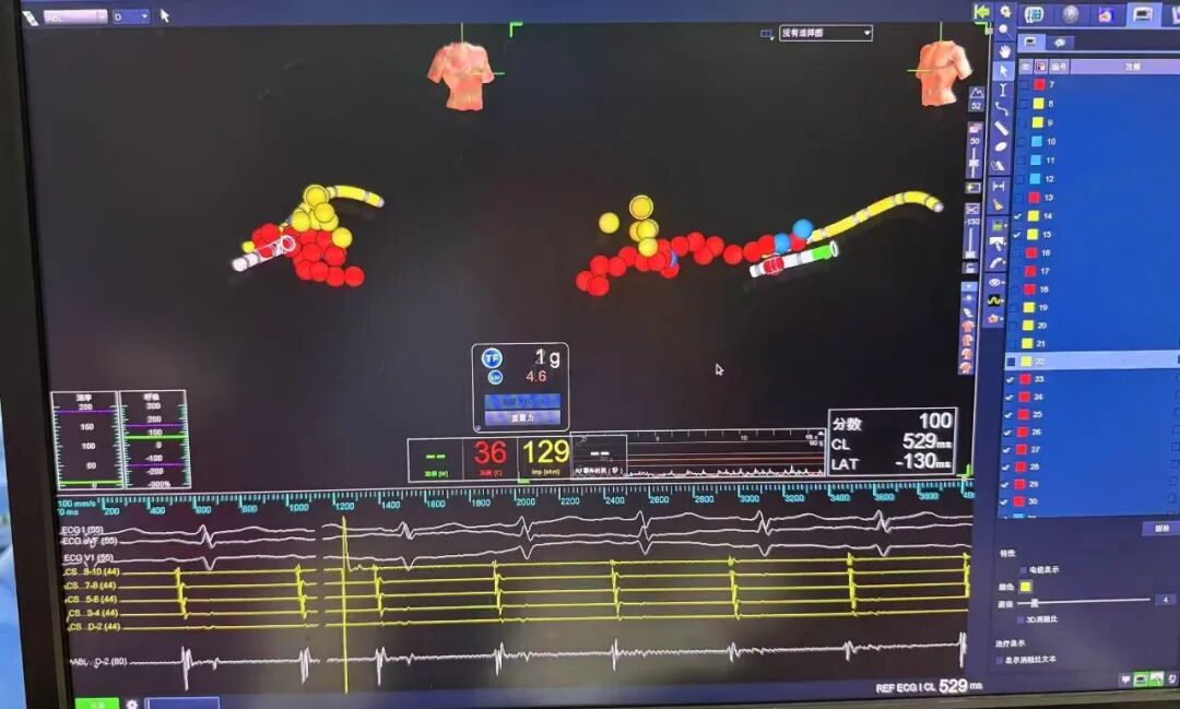 心电图机怎么修精准维修”重获“心”生 ｜ 永城市胸痛中心成功救治56岁心跳“飙车”大叔！_https://www.jmylbn.com_新闻资讯_第11张