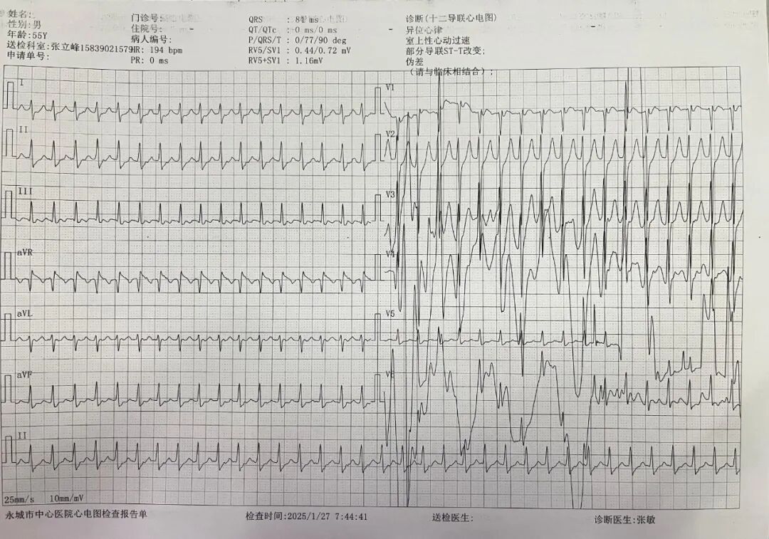 心电图机怎么修精准维修”重获“心”生 ｜ 永城市胸痛中心成功救治56岁心跳“飙车”大叔！_https://www.jmylbn.com_新闻资讯_第12张