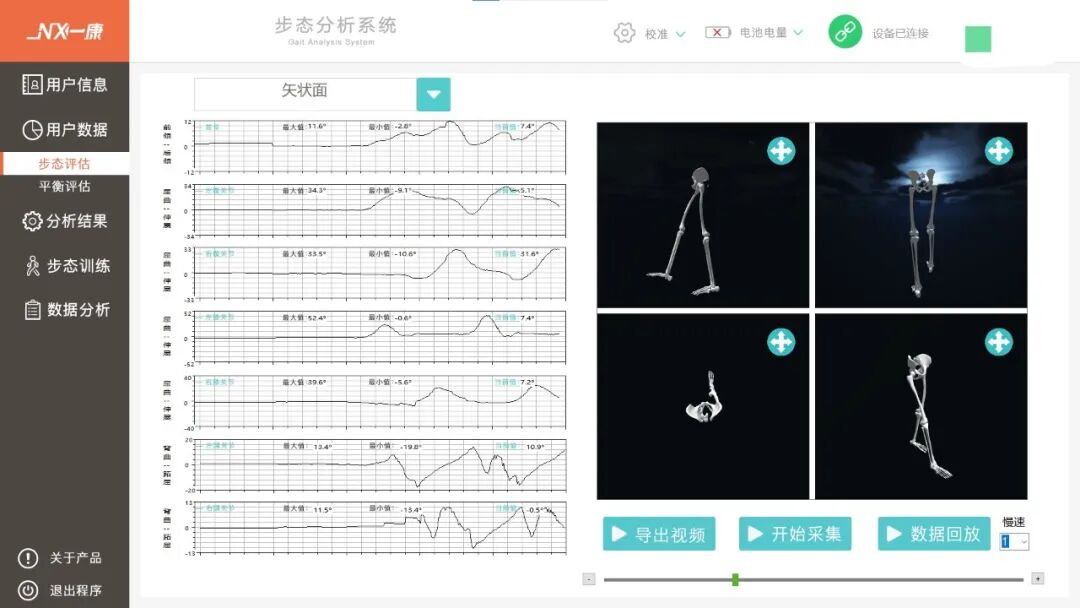 步态分析上曲线怎么解读告别异常步态，解锁健康行走新姿势——我院骨科中心实验室“黑科技”步态分析系统正式投入使用_https://www.jmylbn.com_新闻资讯_第6张
