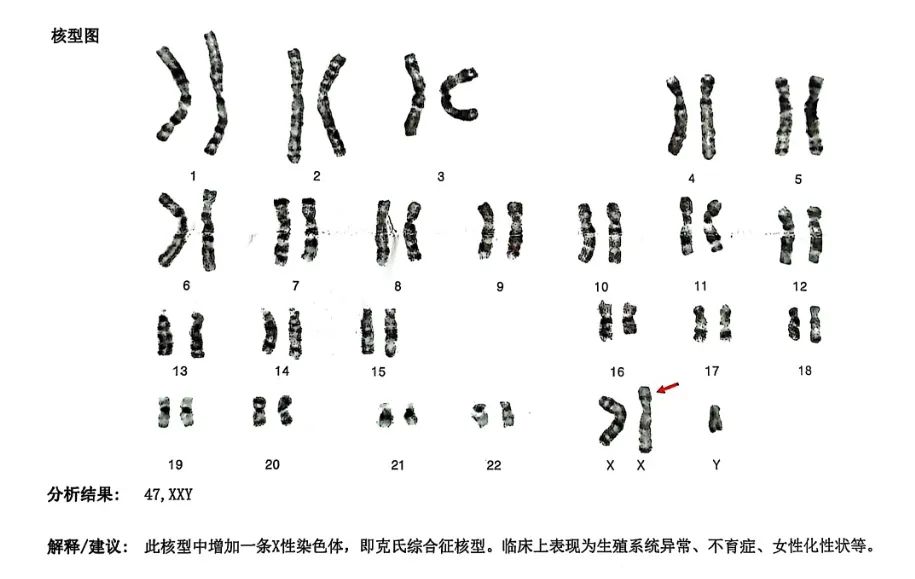 白白净净，不长胡子！23岁小伙被确诊这种罕见病