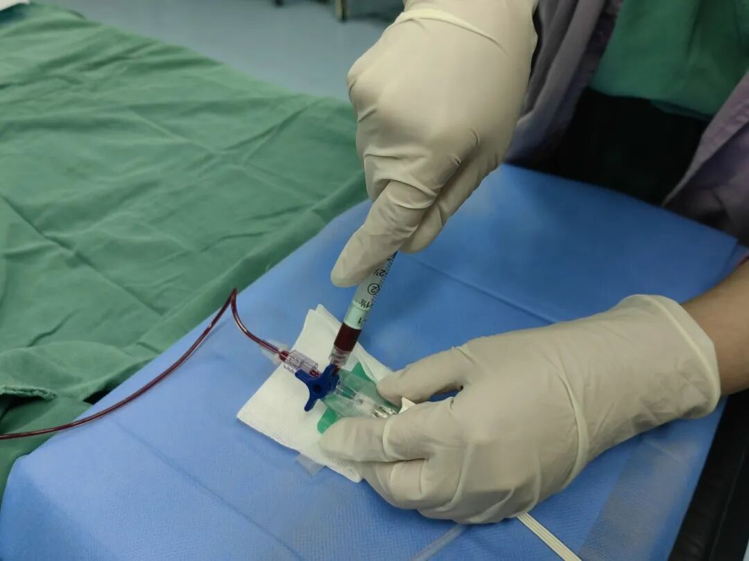 动脉留置针怎么拔做手术为啥要把留置针扎到动脉里？答案在这里_https://www.jmylbn.com_新闻资讯_第5张