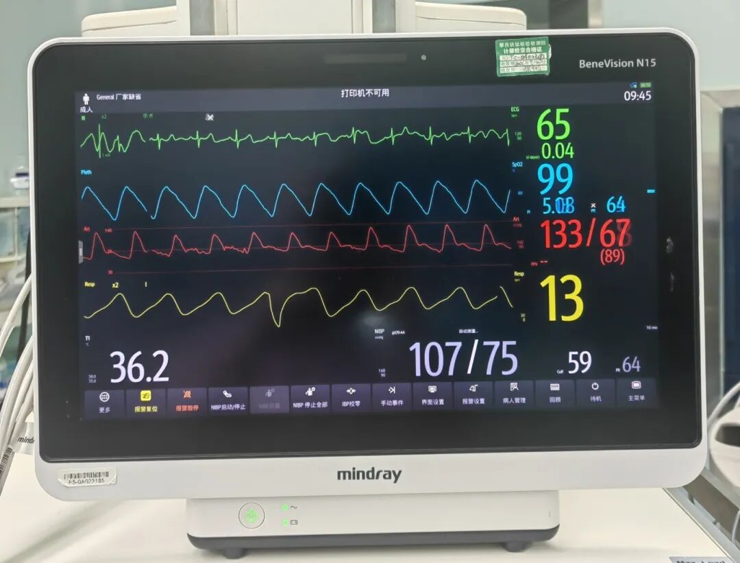 动脉留置针怎么拔做手术为啥要把留置针扎到动脉里？答案在这里_https://www.jmylbn.com_新闻资讯_第3张