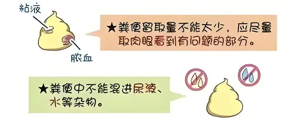 大便送检盒怎么用宝宝便便留取指南：科学操作，轻松送检！_https://www.jmylbn.com_新闻资讯_第3张