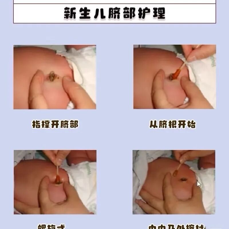 光疗箱报警怎么处理守护初生“晴空”——岳阳市长炼医院儿科开展新生儿黄疸护理业务查房_https://www.jmylbn.com_新闻资讯_第28张