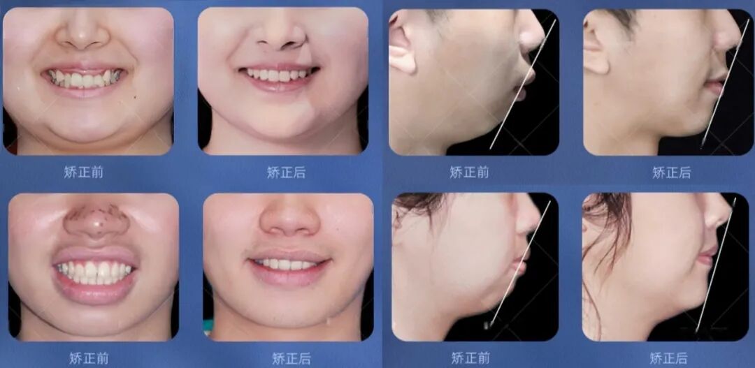 慈恩名人堂 | 林慧：巾帼正畸翘楚，匠心笑颜先锋