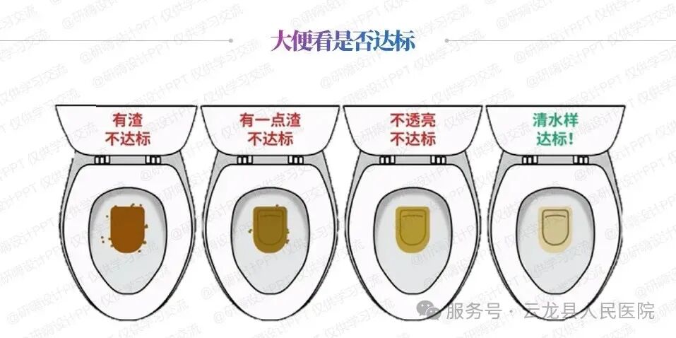 肠镜检查全流程详解：从准备到完成，一文读懂无痛肠镜全过程