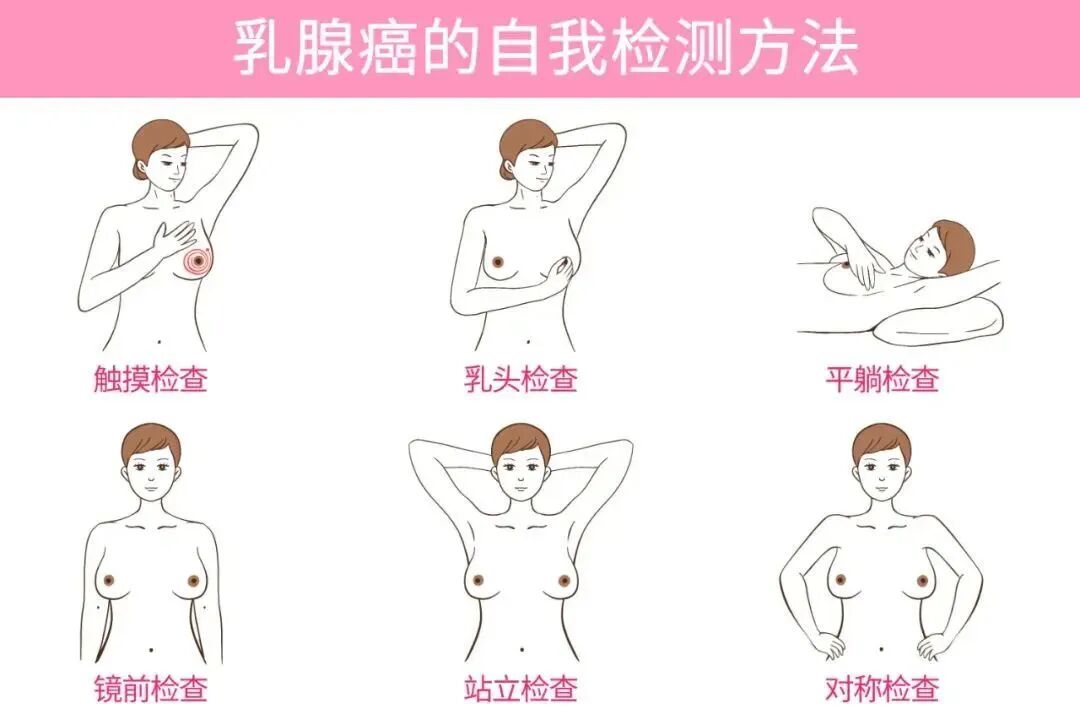 乳腺dr能检查什么乳腺DR检查来了，这些高危人群要注意！_https://www.jmylbn.com_新闻资讯_第5张