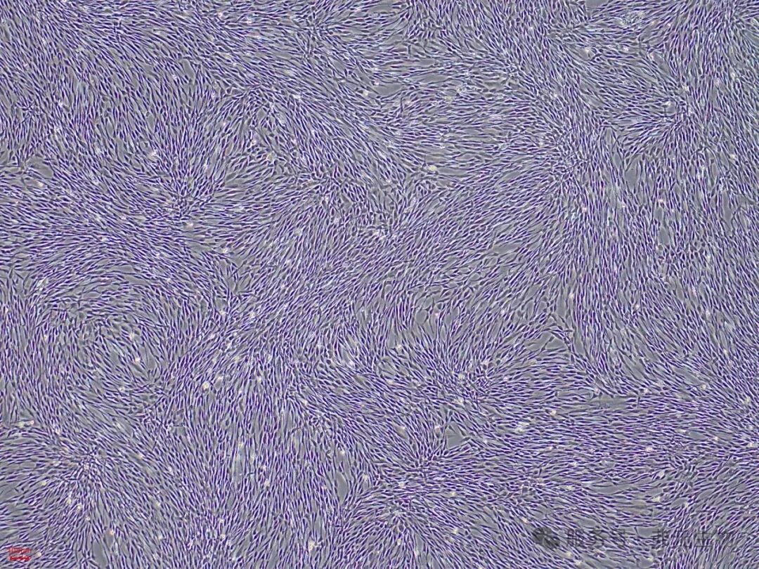 hAMSC-P5-2D-FBS_0530_142042.jpg