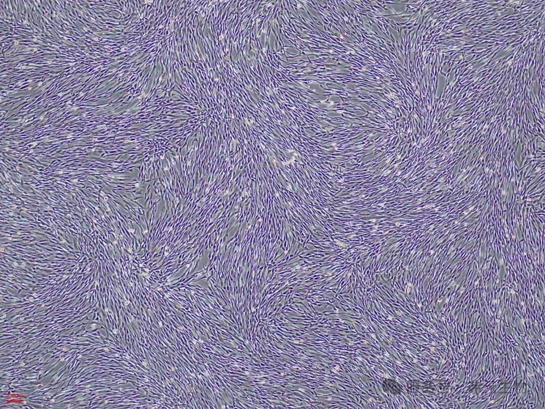 hAMSC-P7-3D-FBS_0606_143657.jpg