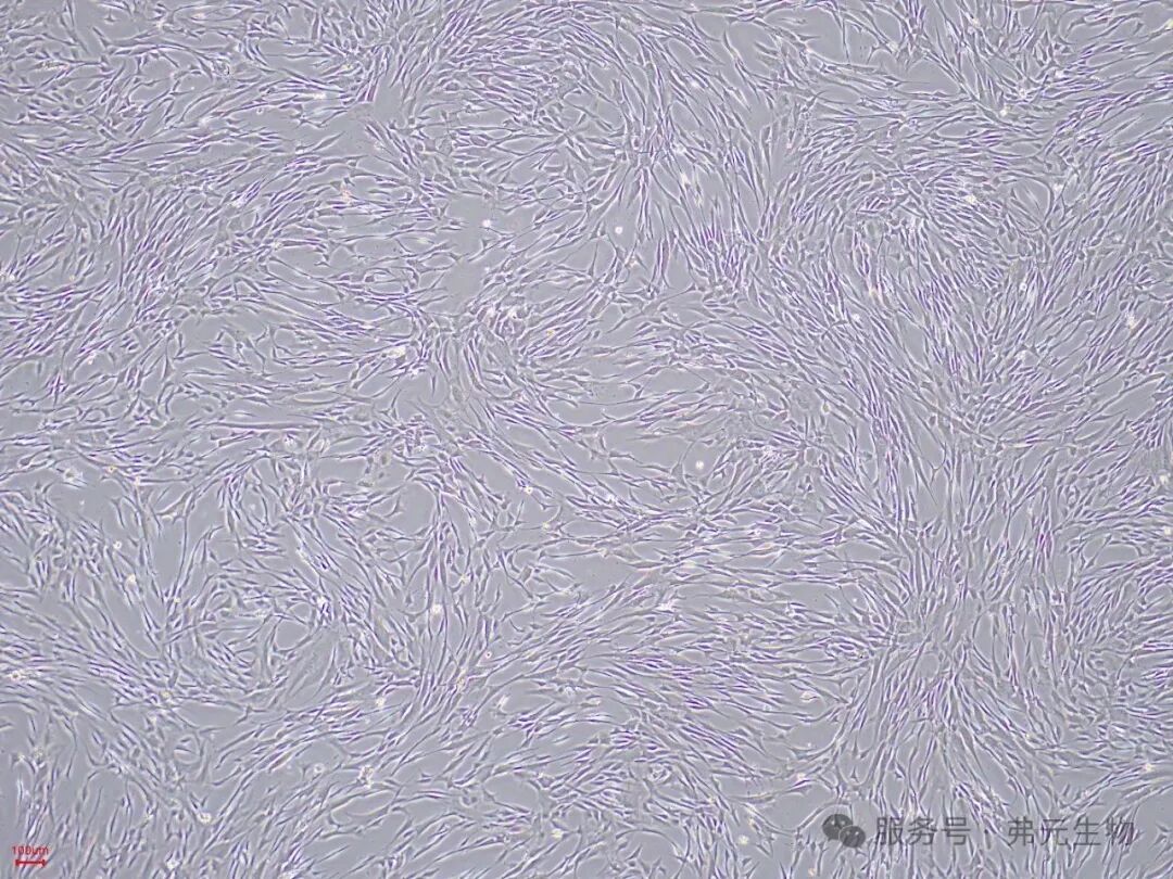 hAMSC-P9-3D-FBS_0616_161105.jpg