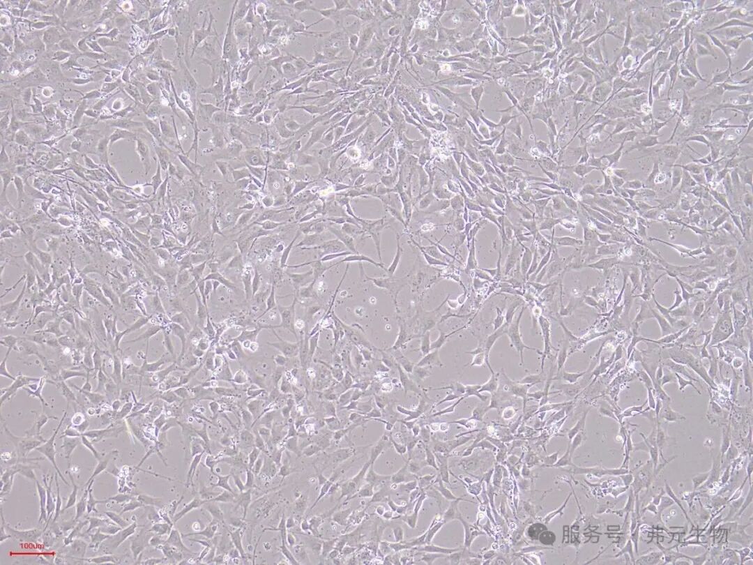 H9-iMSC-P1-10.jpg