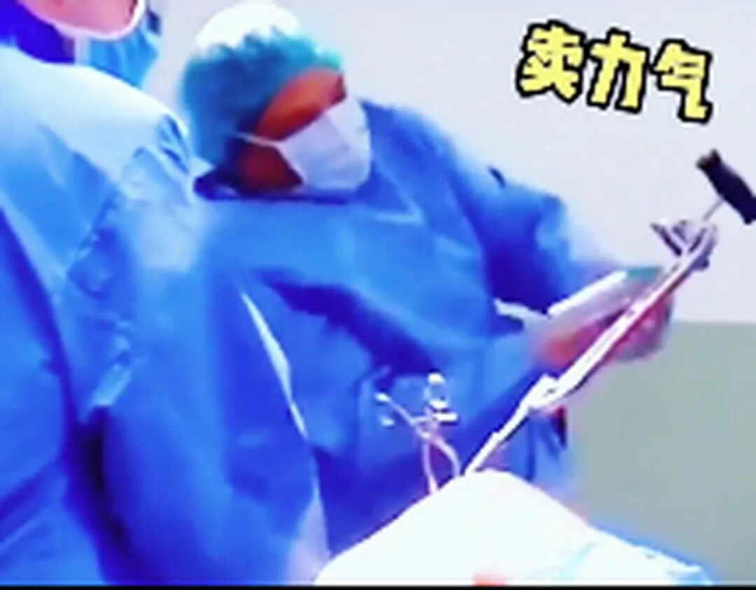 手术电钻怎么用电锯电钻抡大锤，骨科手术蛮怕人？很多专家早就转型玩“针线活”了_https://www.jmylbn.com_新闻资讯_第2张