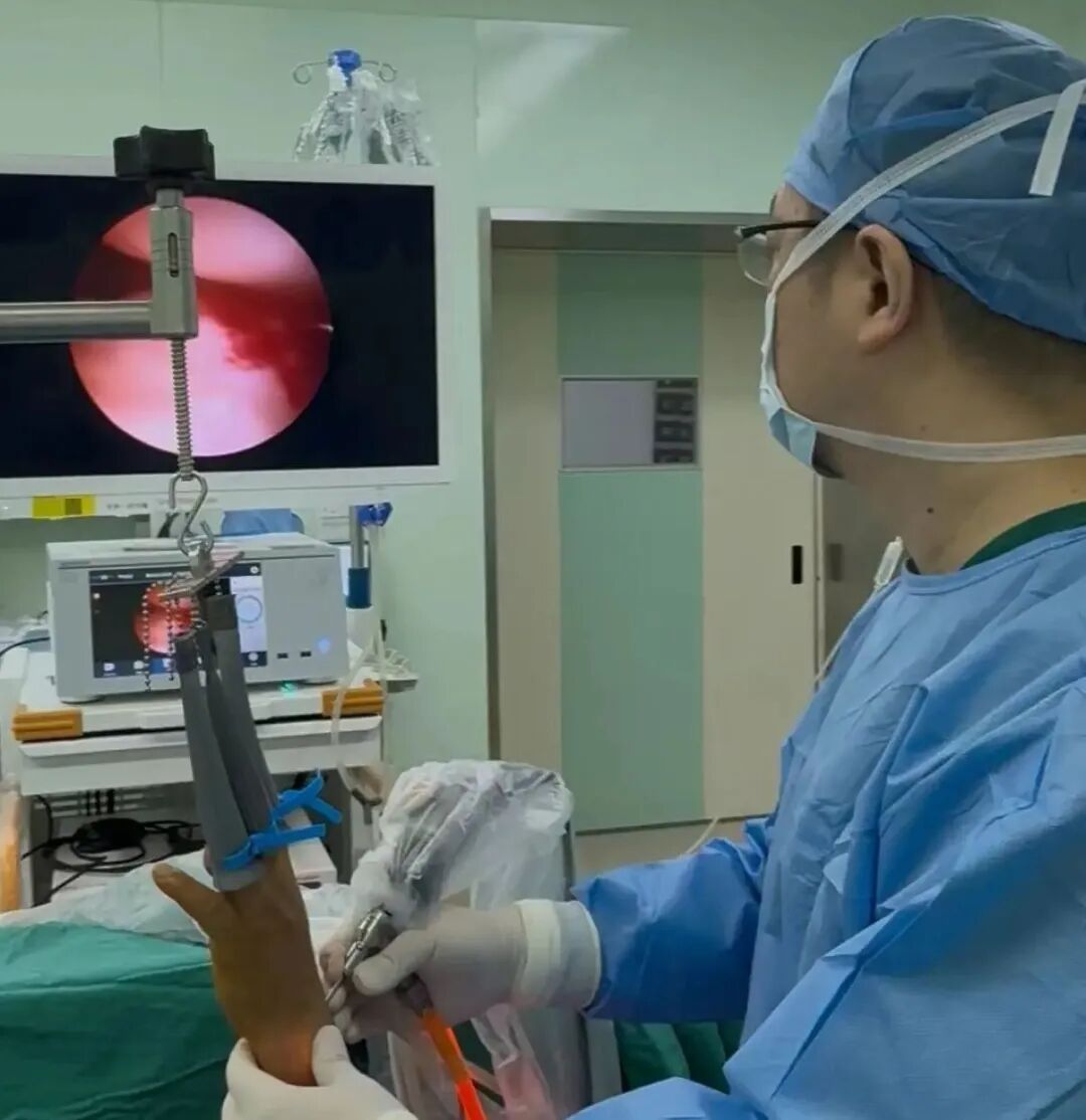 手术电钻怎么用电锯电钻抡大锤，骨科手术蛮怕人？很多专家早就转型玩“针线活”了_https://www.jmylbn.com_新闻资讯_第10张