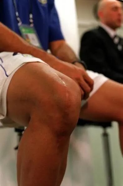 手术电钻怎么用电锯电钻抡大锤，骨科手术蛮怕人？很多专家早就转型玩“针线活”了_https://www.jmylbn.com_新闻资讯_第6张