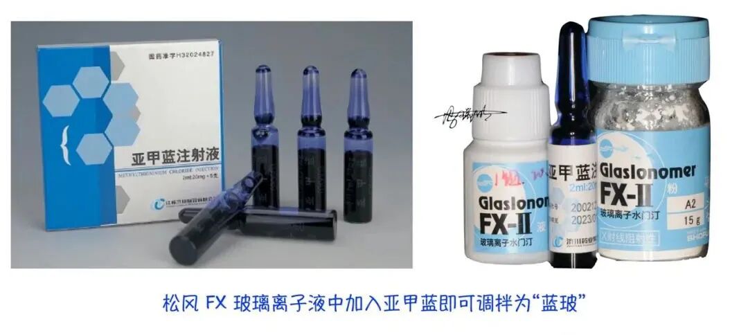 蓝玻在根管治疗中的应用