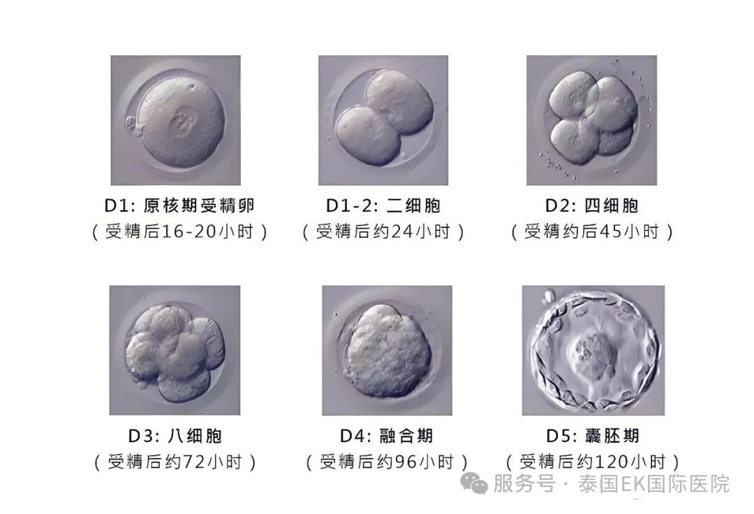 泰国试管D5-D7的囊胚等级EKI-IVF是如何划分的
