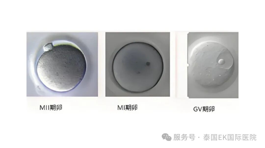 EKI-IVF取出的未成熟卵子丢弃or继续培养