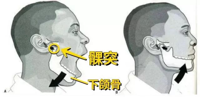 口腔健康科普｜知名歌手摔倒，下巴受伤缝30针，摔到下巴后果为何如此严重！-健康知识-南方医科大学深圳口腔医院（坪山）