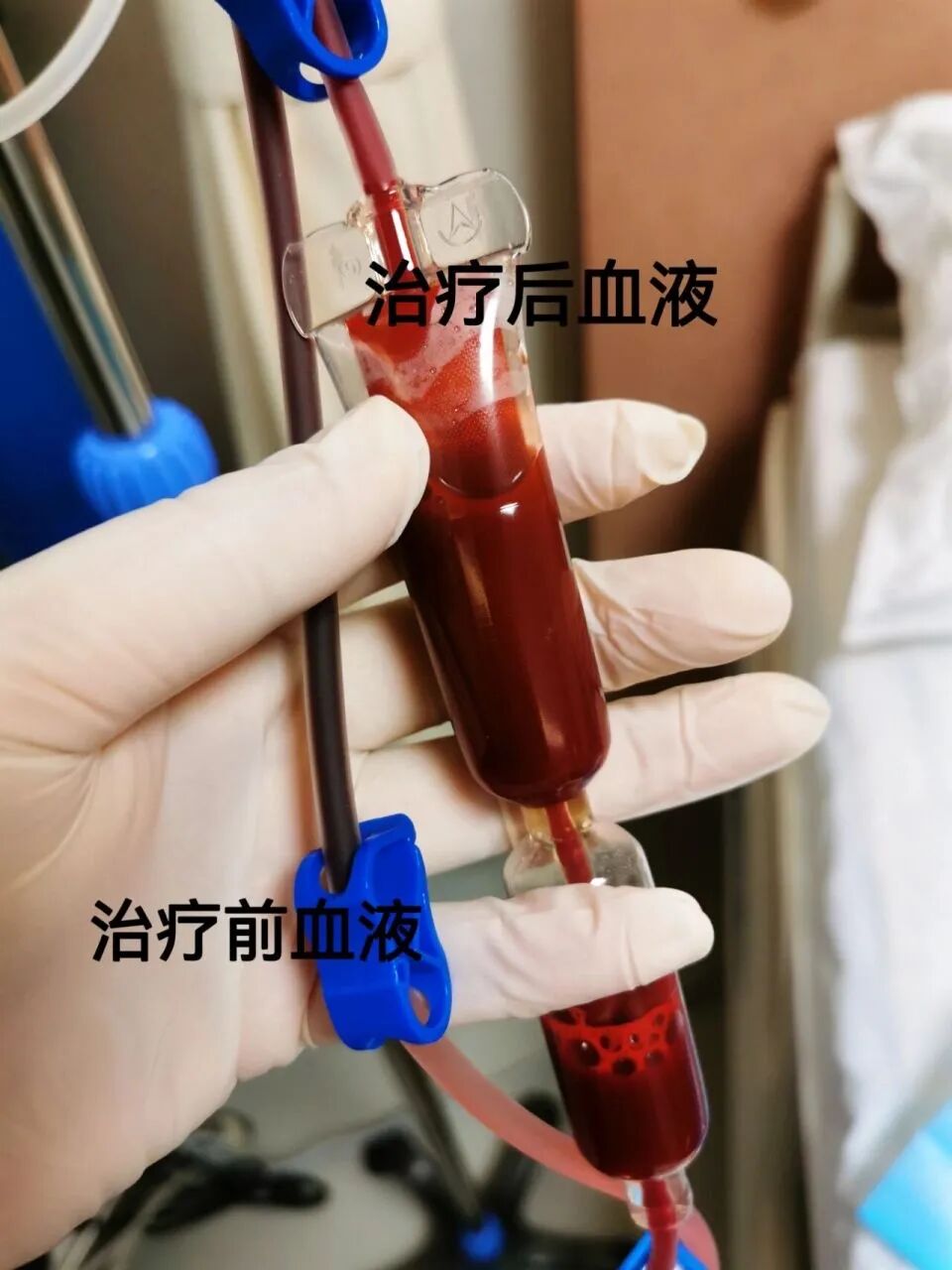 三氧治疗什么免疫力低下、慢性炎症反复？这种“绿色疗法”或许能帮到你！_https://www.jmylbn.com_新闻资讯_第8张