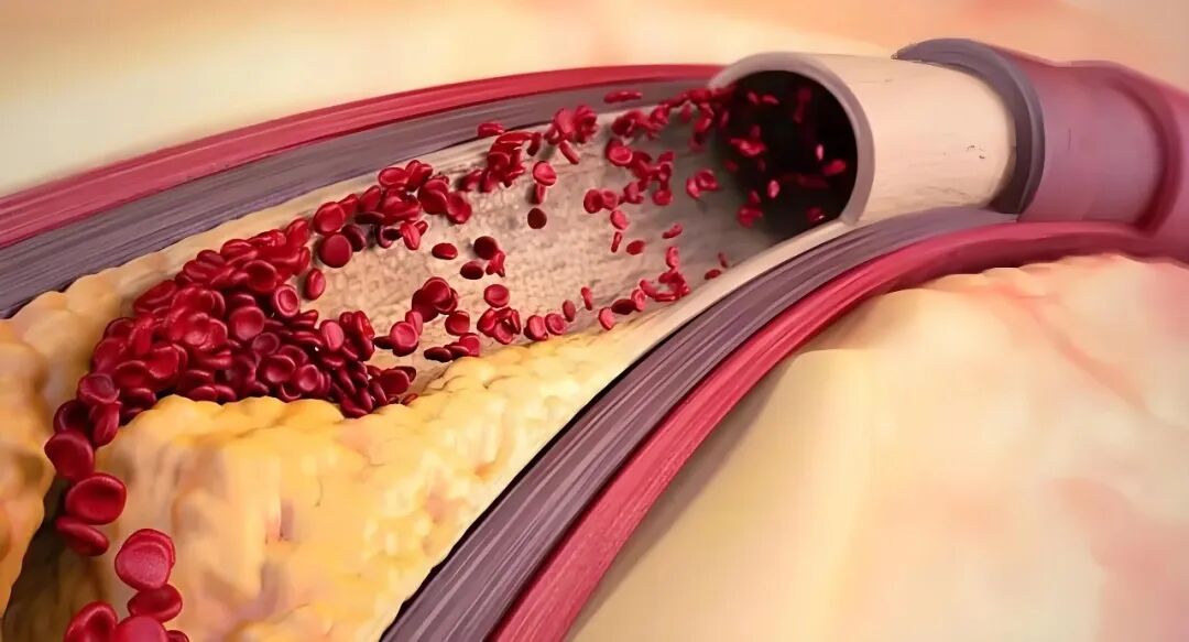 三氧治疗什么免疫力低下、慢性炎症反复？这种“绿色疗法”或许能帮到你！_https://www.jmylbn.com_新闻资讯_第10张