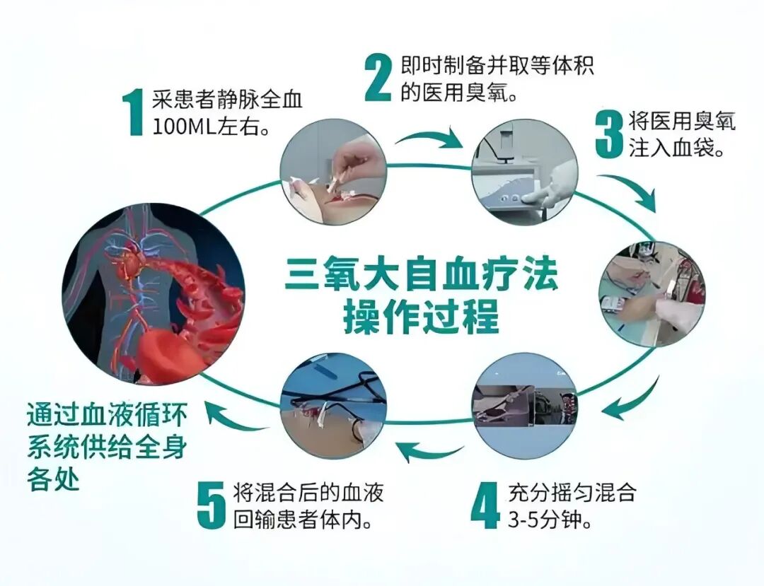 三氧治疗什么免疫力低下、慢性炎症反复？这种“绿色疗法”或许能帮到你！_https://www.jmylbn.com_新闻资讯_第6张