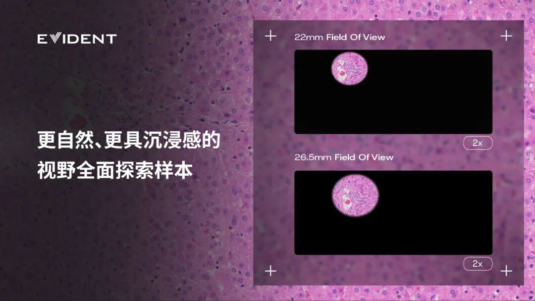 奧偉登發(fā)布全新沉浸式超寬視野顯微鏡，助力精準(zhǔn)病理決策！
