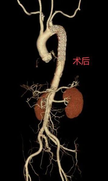 5.6三维.jpg