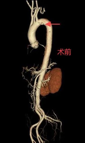 4.25三维.jpg
