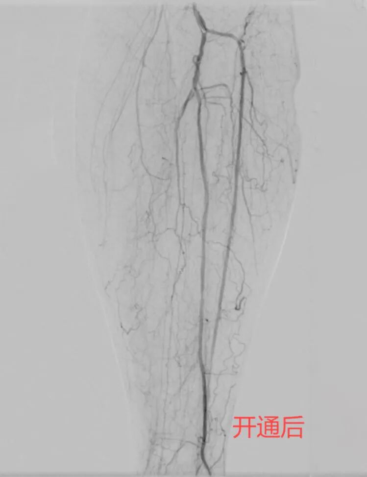 小腿2(1).jpg