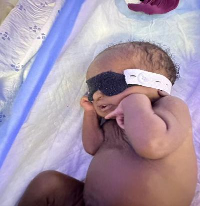 光疗时为什么黑眼罩【妇幼人文】巧手以柔光 暖护新生眸│援外护士用冲锋衣爆改护眼罩_https://www.jmylbn.com_新闻资讯_第8张