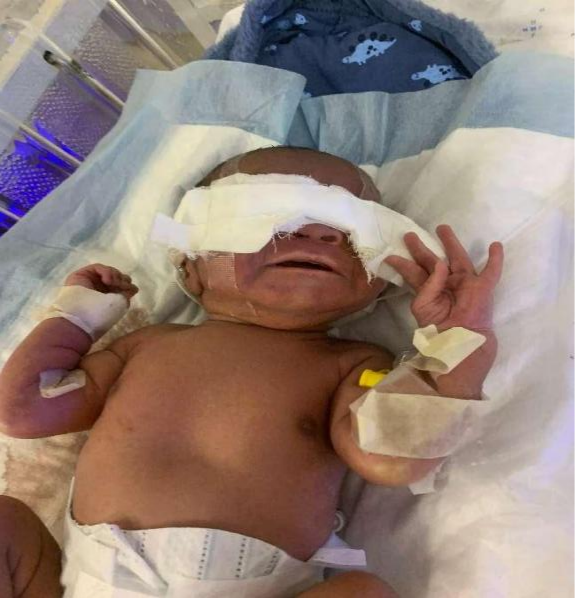 光疗时为什么黑眼罩【妇幼人文】巧手以柔光 暖护新生眸│援外护士用冲锋衣爆改护眼罩_https://www.jmylbn.com_新闻资讯_第4张